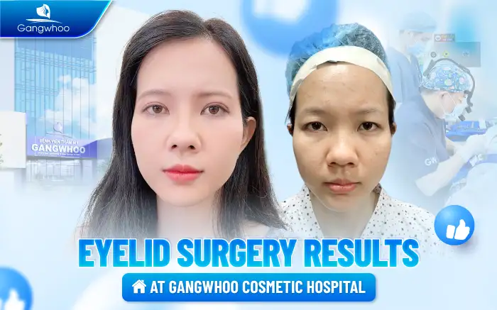 What Are the Side Effects of Eyelid Surgery? How Does It Affect Health?