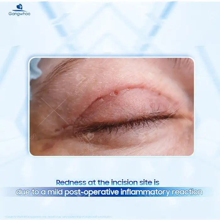 Lưu nháp tự động