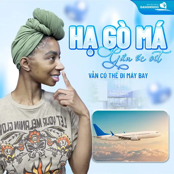 Hạ gò má gắn ốc vít vẫn có thể đi máy bay