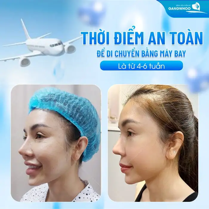 Thời điểm an toàn để di chuyển bằng máy bay là từ 4-6 tuần