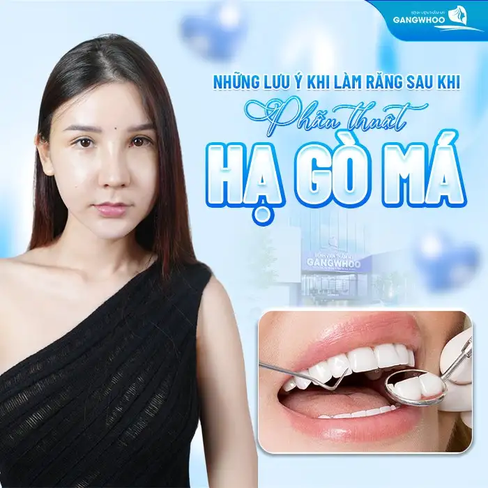 Những lưu ý khi làm răng sau khi phẫu thuật hạ gò má