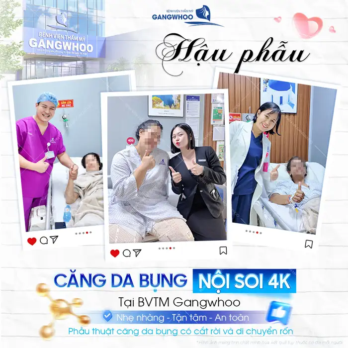 Căng Da Bụng (Abdominoplasty) Là Gì? Chi Phí, Hồi Phục & Kết Quả Thực Tế