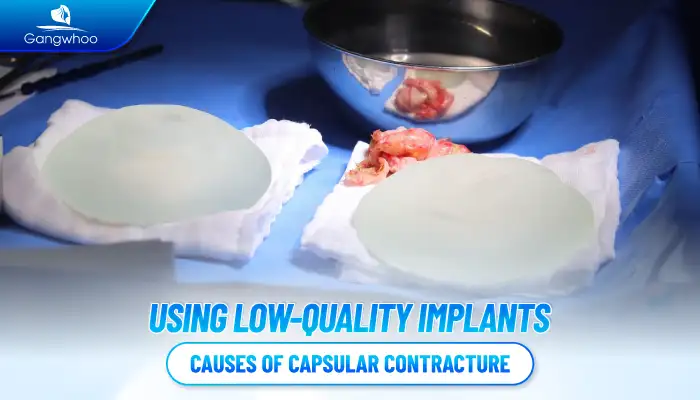 What is capsular contracture after breast augmentation? What causes capsular contracture?
