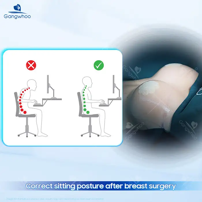How to Sit Up by Yourself After Breast Augmentation Without Affecting Implants