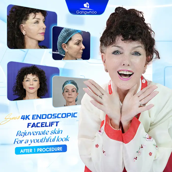 How Much Does an Endoscopic Facelift Cost? Updated Latest Price List 2026