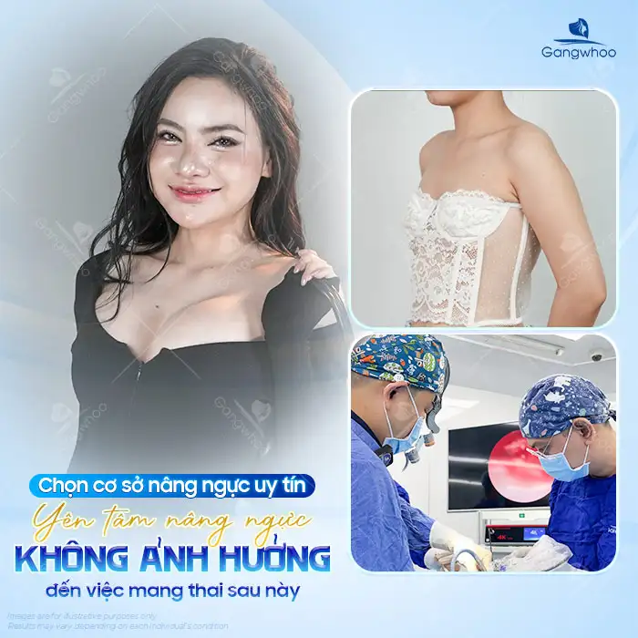Should You Get Breast Augmentation Before Having Children? Does It Have Any Impact?
