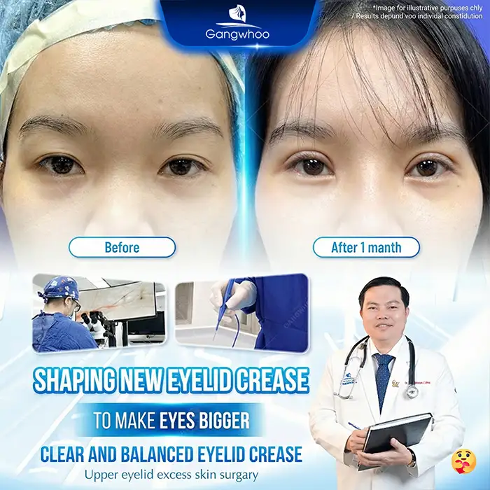 Latest Eyelid Surgery Technologies to Consider in 2026