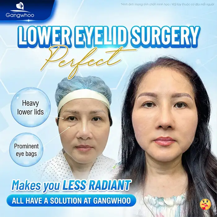 Latest Eyelid Surgery Technologies to Consider in 2026