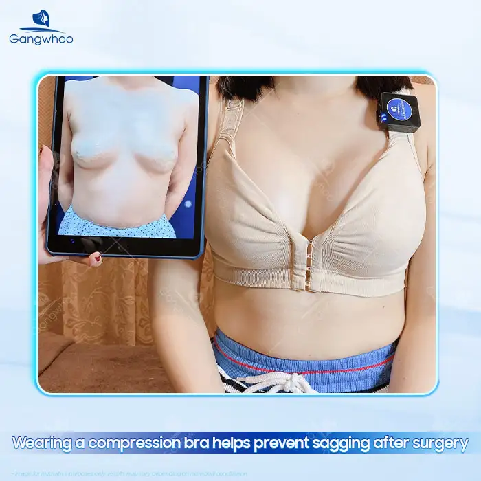en nang nguc cho con bu co bi xe khong 3