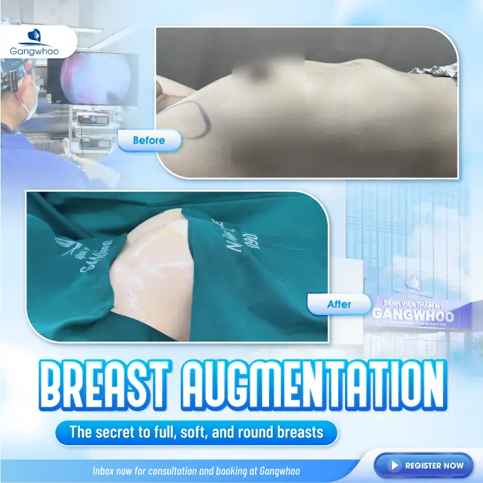 What is male breast augmentation? How is it different from female breast augmentation