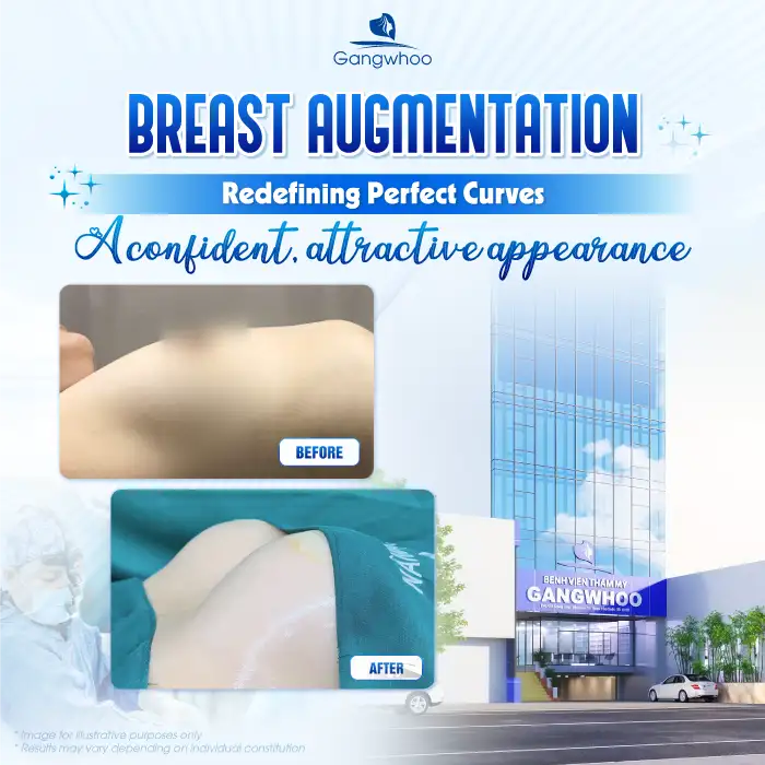 What is male breast augmentation? How is it different from female breast augmentation