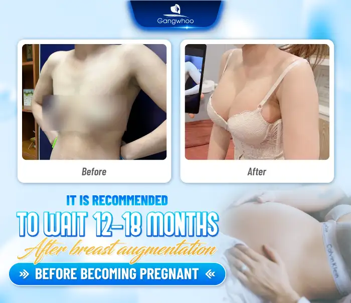 Can you get pregnant after breast augmentation? Does it affect the fetus? 3 Can you get pregnant after breast augmentation? Does it affect the fetus?