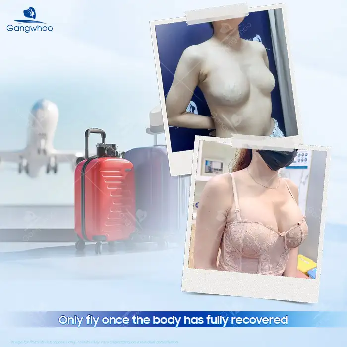 Can You Fly After Breast Augmentation? Is There a Risk of Implant Rupture on a Plane?