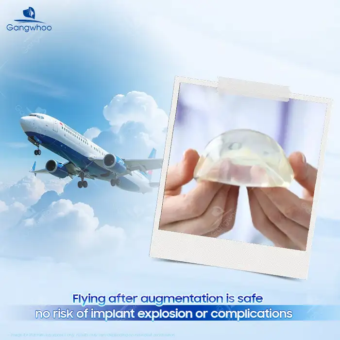 Can You Fly After Breast Augmentation? Is There a Risk of Implant Rupture on a Plane?