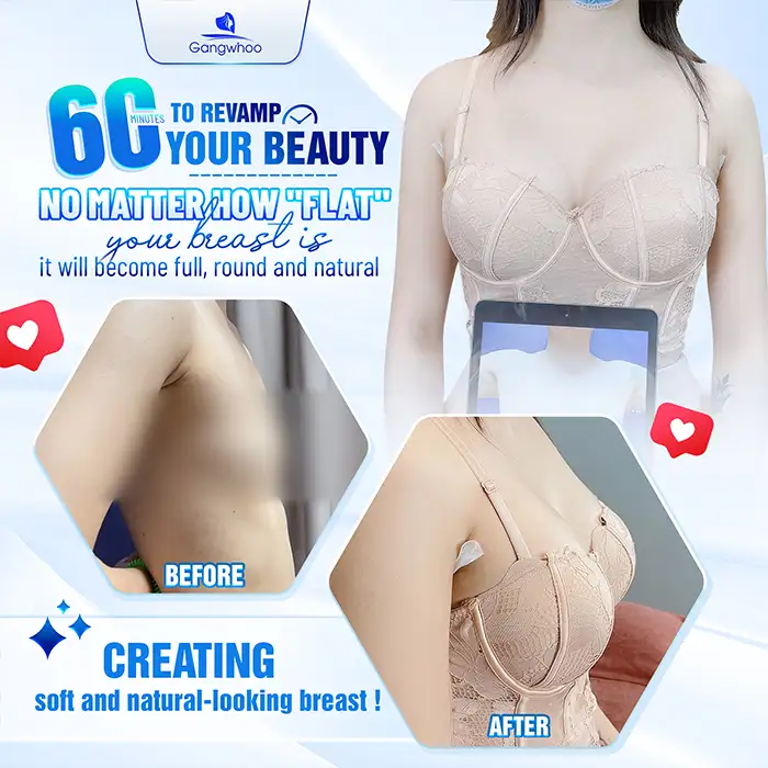 What is inframammary fold breast augmentation? Who is it suitable for?