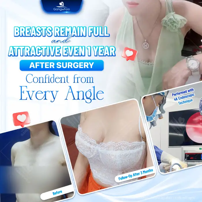 What Is 3D Endoscopic Breast Augmentation? Pros and Cons of 3D Endoscopic Breast Augmentation