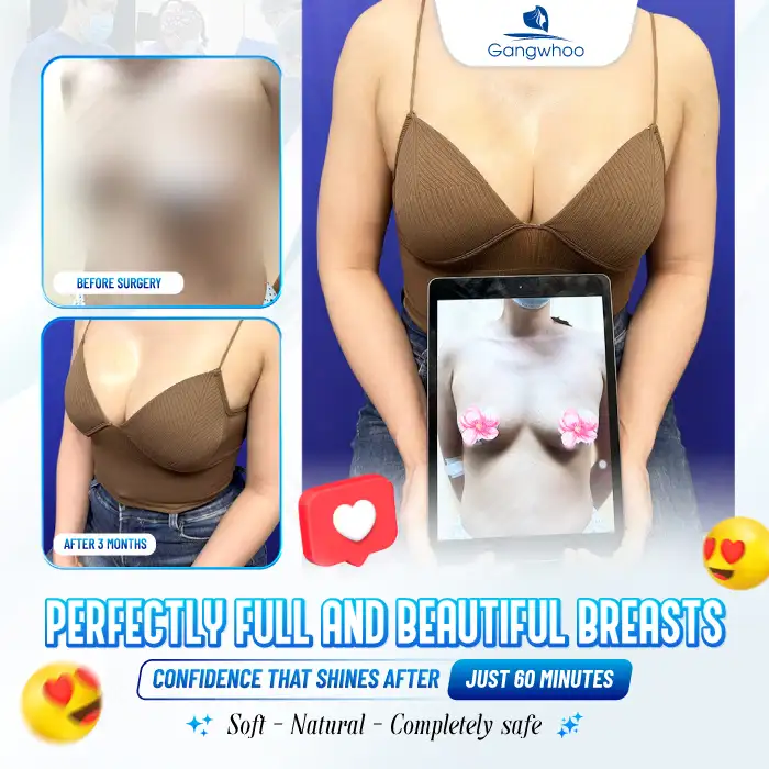 Which Breast Implants Should You Choose? The Best Types of Breast Implants