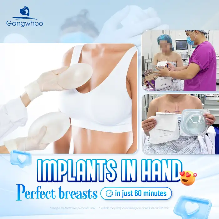 Which Breast Implants Should You Choose? The Best Types of Breast Implants