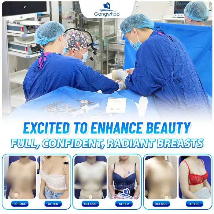 How Long Does Breast Augmentation Surgery Take? Which Incision Heals the Fastest?