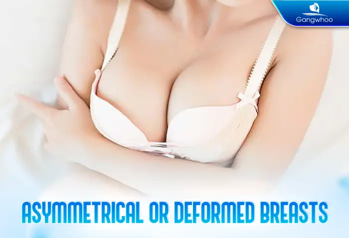 What are the risks of breast augmentation? What should be noted before undergoing the procedure