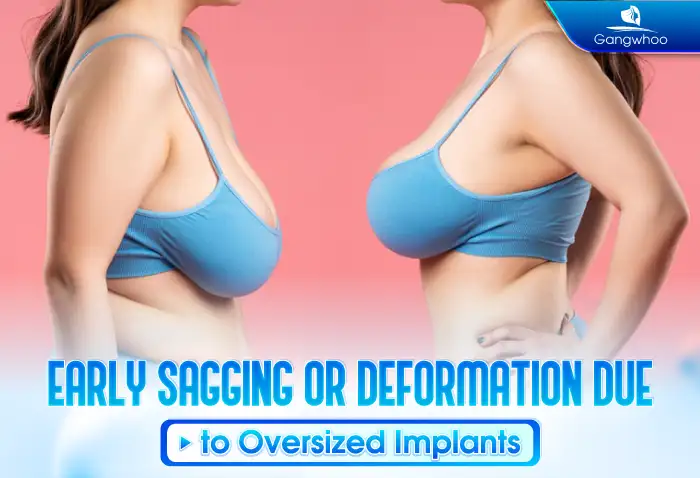 What are the risks of breast augmentation? What should be noted before undergoing the procedure