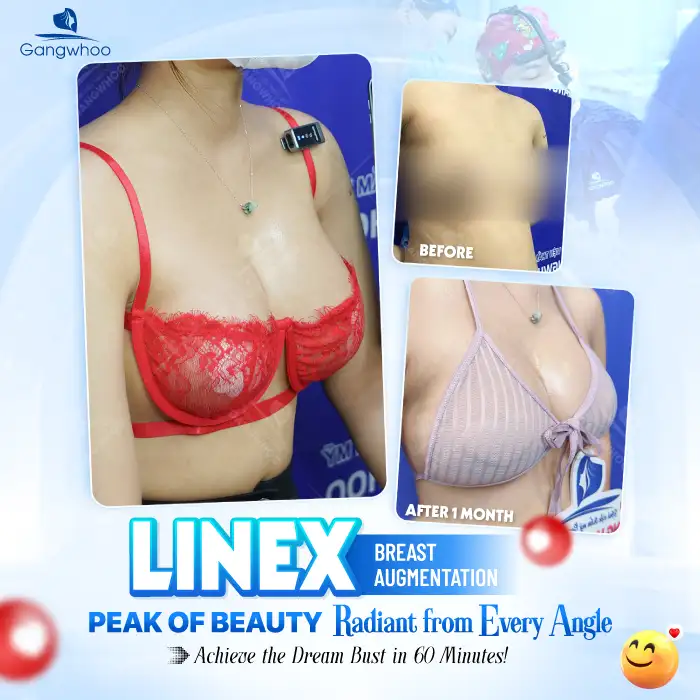 What are the risks of breast augmentation? What should be noted before undergoing the procedure