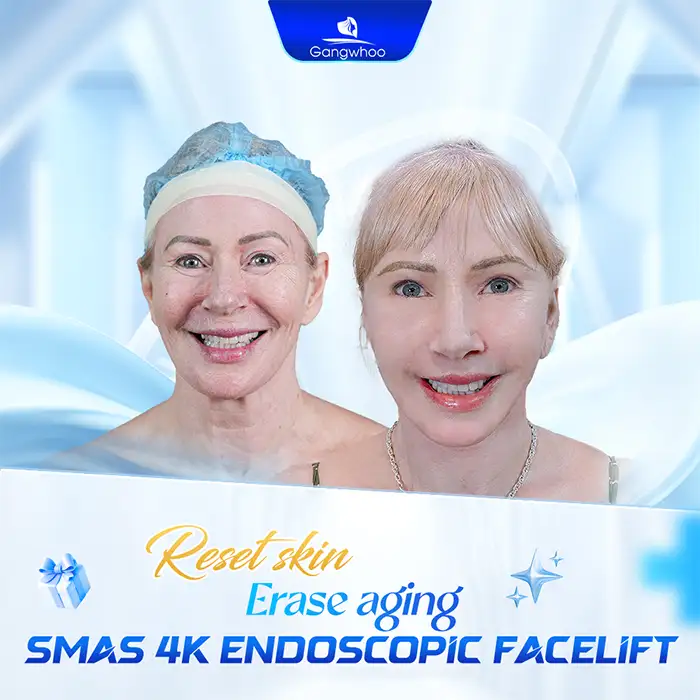 At What Age Should You Get a Facelift? The Ideal Age for a Facelift