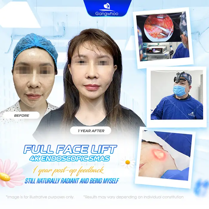 Lưu nháp tự động