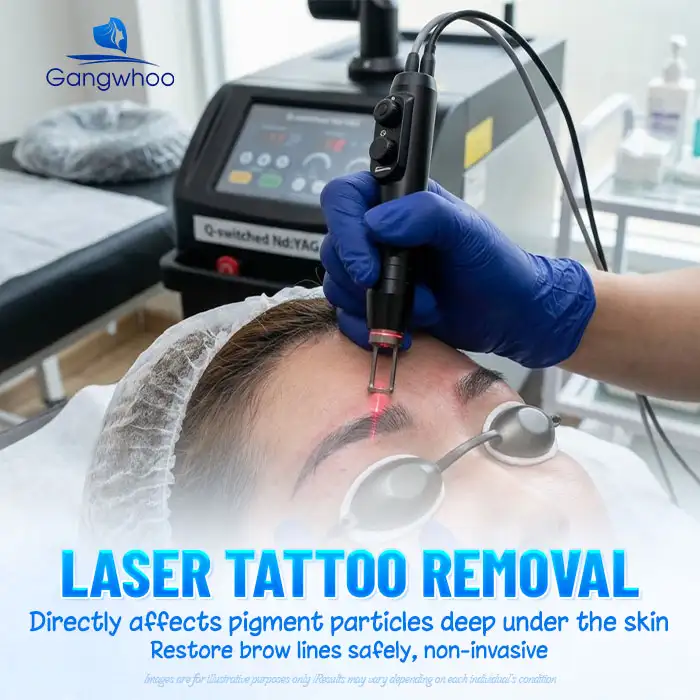Safe and Effective Ways to Remove Tattooed Eyebrows at Home