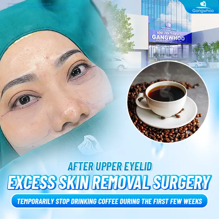 Can You Drink Coffee After Double Eyelid Surgery? How Long Should You Avoid Coffee?