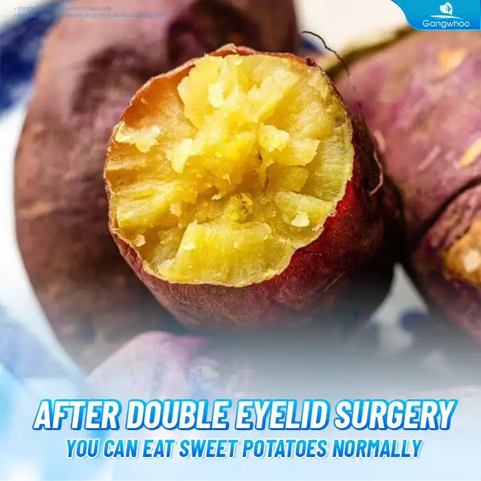 Can You Eat Sweet Potatoes After Eyelid Surgery? Important Notes When Eating Sweet Potatoes