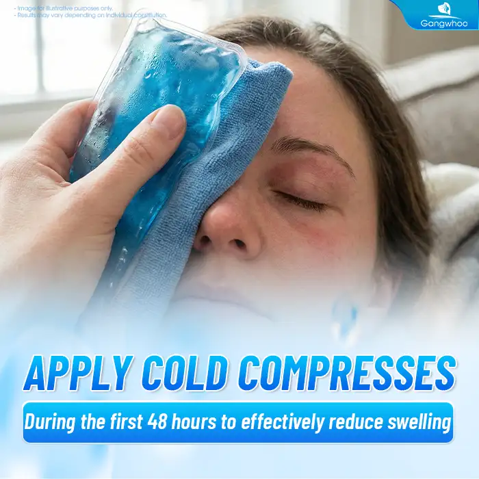 How long does swelling last after Mini Deep eyelid surgery? Recovery time