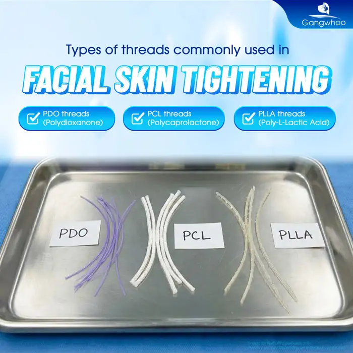 Is Facial Thread Lifting Effective? Does It Provide Long-Term Results?