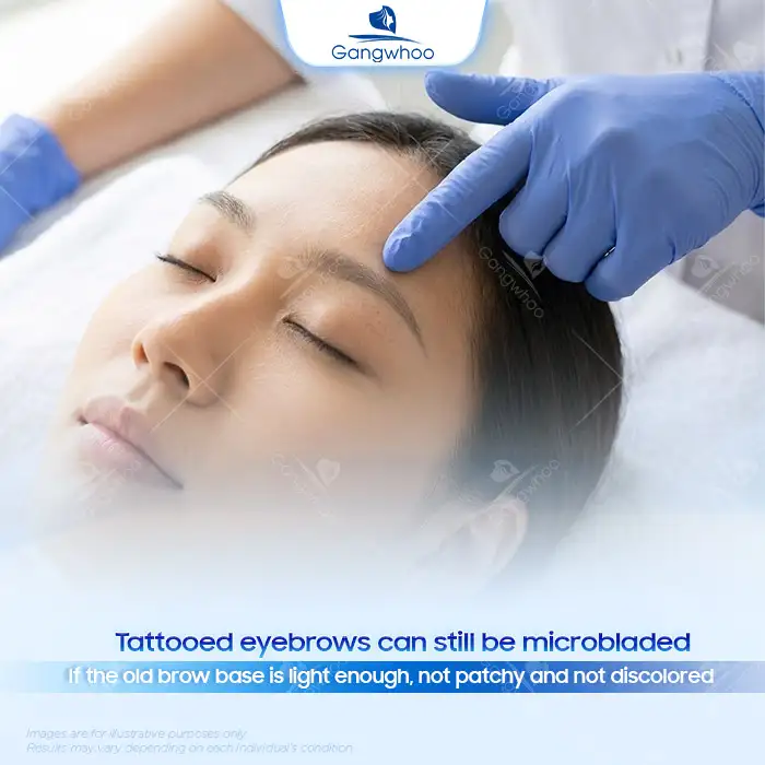 Can Tattooed Eyebrows Be Microbladed? Detailed Explanation from the Doctor