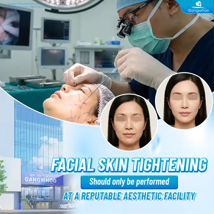 Should You Get a Thread Lift? Important Considerations Before the Procedure