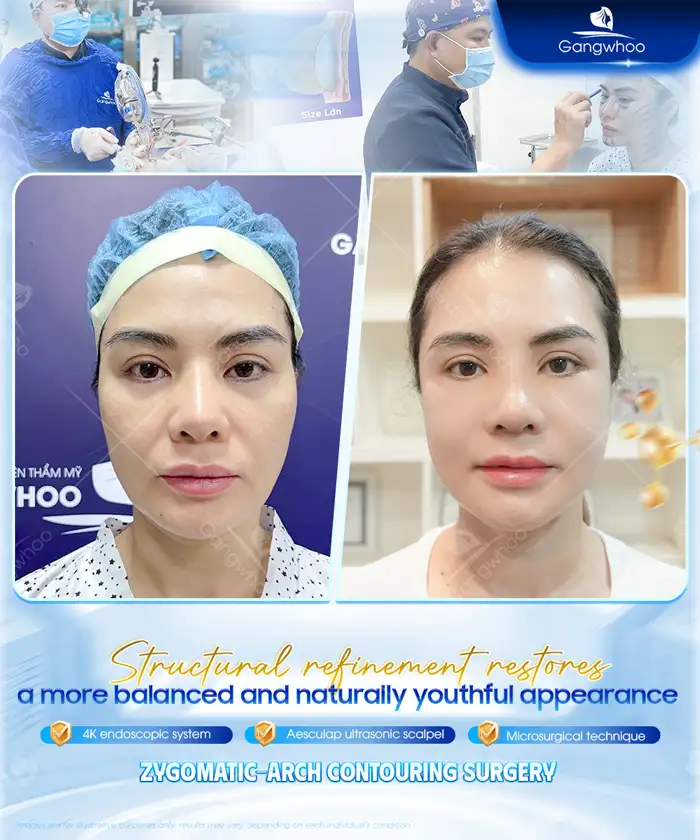 Lưu nháp tự động