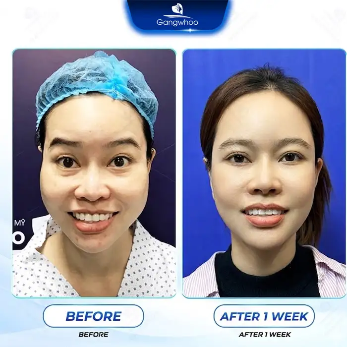 Lưu nháp tự động