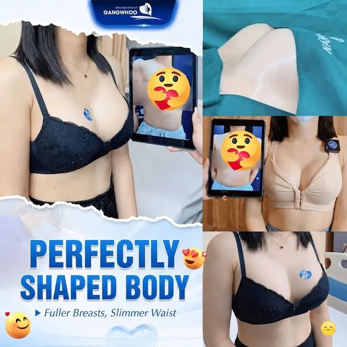 Is the Fat Transfer Breast Augmentation Method Using Abdominal Liposuction Safe and Effective?