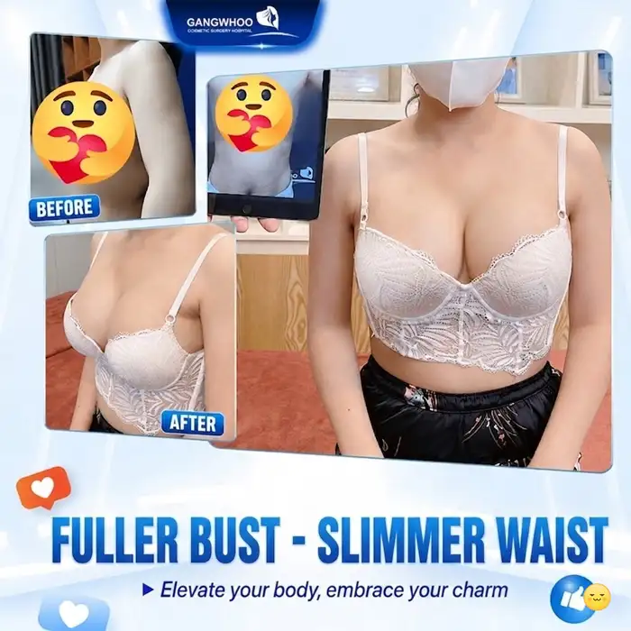 Is the Fat Transfer Breast Augmentation Method Using Abdominal Liposuction Safe and Effective?
