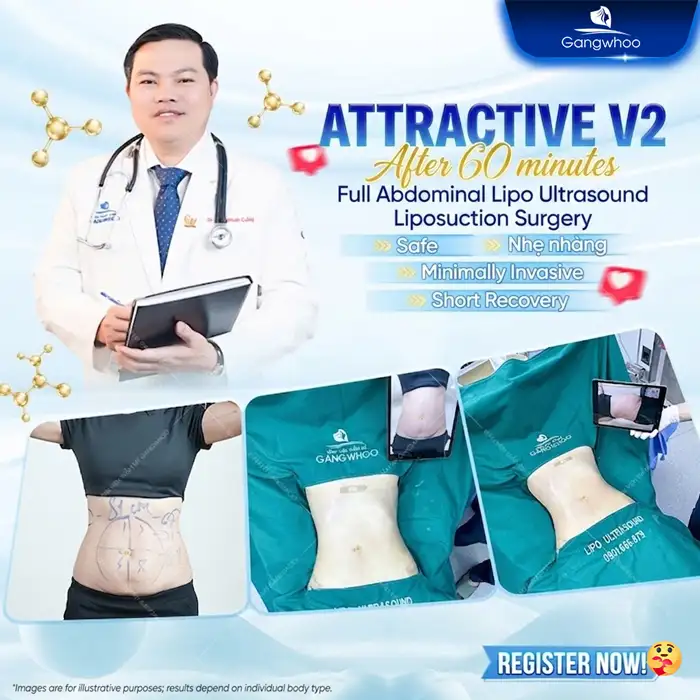 What Is Non-Surgical Abdominal Fat Removal? Does It Deliver High Effectiveness?
