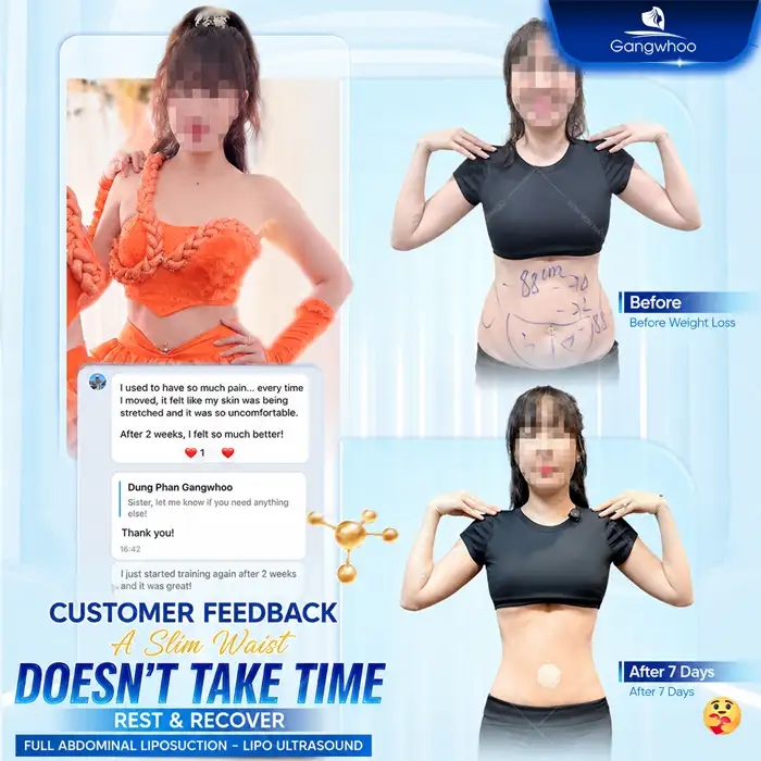 What Is Non-Surgical Abdominal Fat Removal? Does It Deliver High Effectiveness?