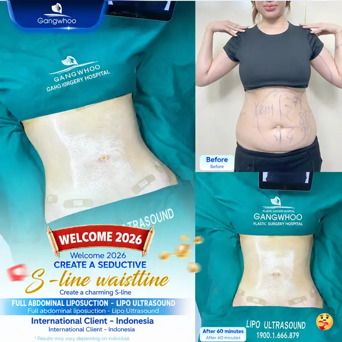 What Is Non-Surgical Abdominal Fat Removal? Does It Deliver High Effectiveness?