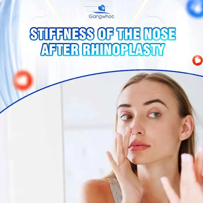 Nasal Tip Hardness After Rhinoplasty: Causes and Treatment Options