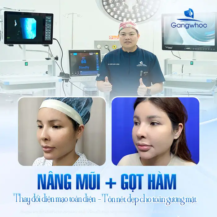 Can Rhinoplasty and Jaw Reduction Surgery Be Performed at the Same Time? Does It Affect Health?