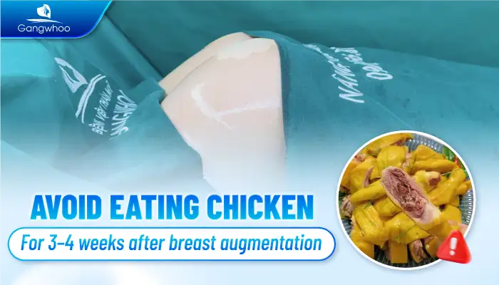 Can You Eat Chicken After Breast Augmentation? How Long Should You Avoid It?