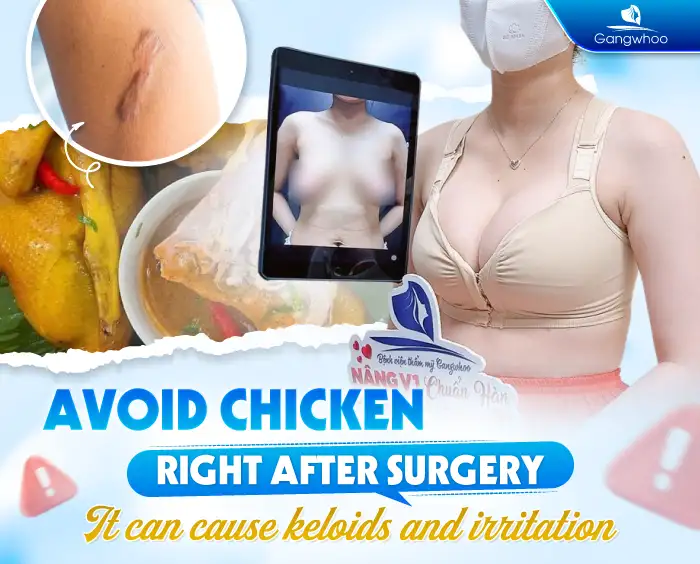 Can You Eat Chicken After Breast Augmentation? How Long Should You Avoid It?