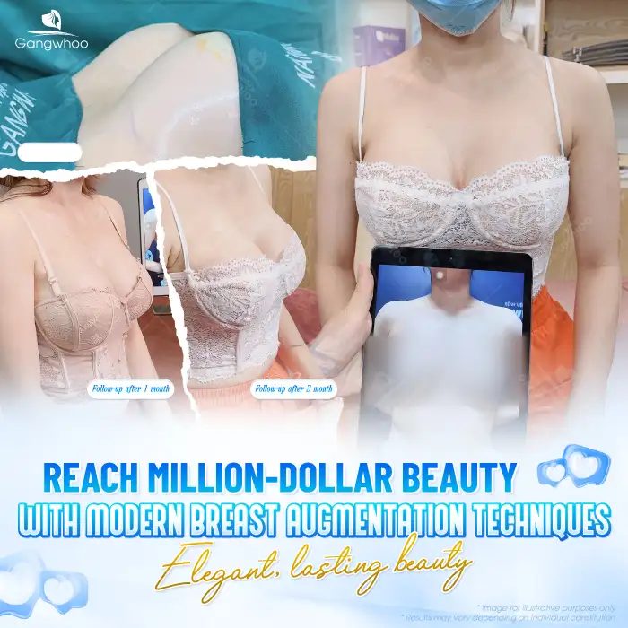 Lưu nháp tự động