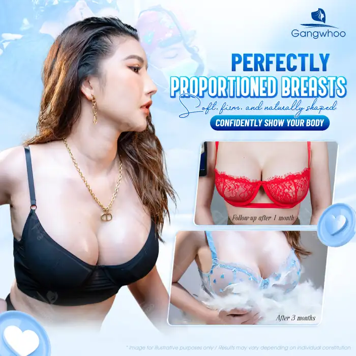 What Is a Motiva Breast Implant? How Many Types of Motiva Breast Implants Are There?