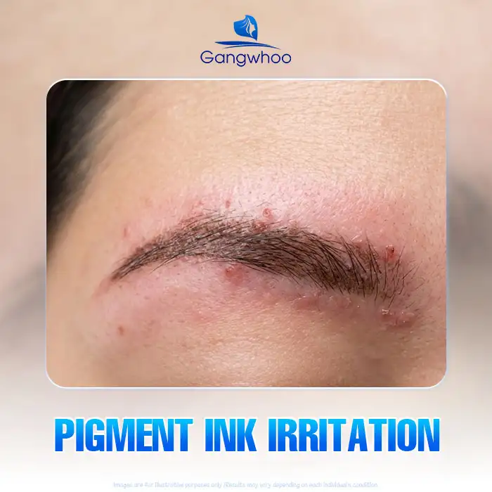 Lưu nháp tự động