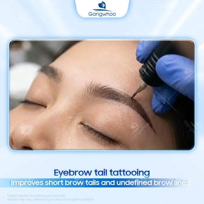 What Is Eyebrow Tail Tattooing? Who Is Suitable for Eyebrow Tail Tattooing?
